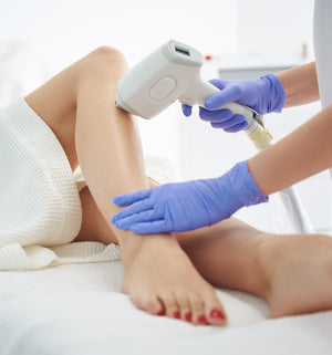 Sclerotherapy, Non-Surgical Treatment, Vessel Malformation, Spider Veins, Varicose Veins, Manchester, Greater Manchester, Cheshire, Wilmslow, UK, London, Specialist, Rejuvenation. 
