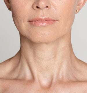 Neck Lines, Wrinkles, Skin Boosters, M22 Laser Resurfacing, Radio Frequency, HIFU, Anti-Wrinkle Injections, Radiesse, Sun Damage, Youthful, Glow, Manchester, Greater Manchester, Cheshire, Wilmslow, UK, London, Specialist, Rejuvenation. 